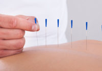 Comparison between physiotherapy and acupuncture